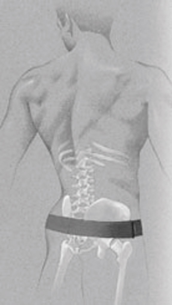 Serola Sacroiliac Belt - CMT Medical