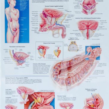 The Prostate Chart_5794